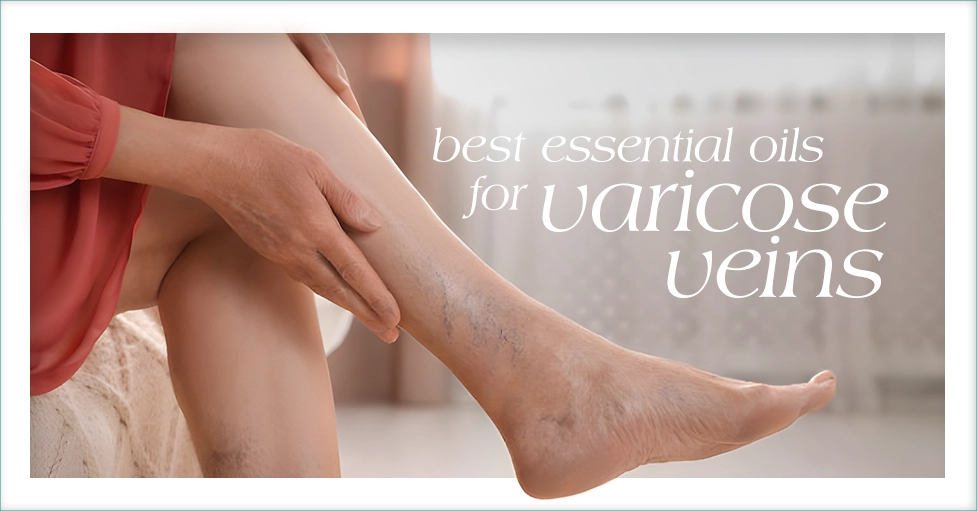 Best Essential Oils For Vaccine Veins Featured Image