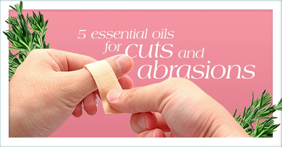 5 Essential Oils for Cuts and Abrasions featured Image