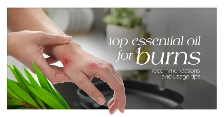 Top Essential Oil for Burns Recommendations and Usage Tips Featured Images